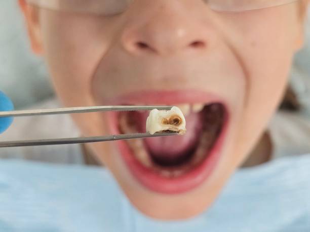 Best Emergency Denture Repair in New Brockton, AL